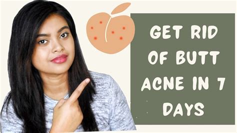 Acne Butt Cure